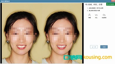 DSD美學(xué)設(shè)計口腔管理軟件自動智能,操作人性化